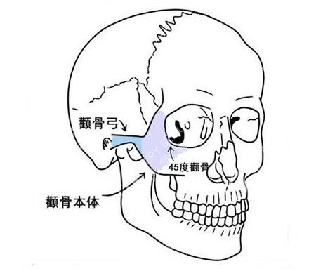 颧骨颧弓展示图卡通照片