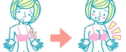 自体脂肪丰胸的前后变化