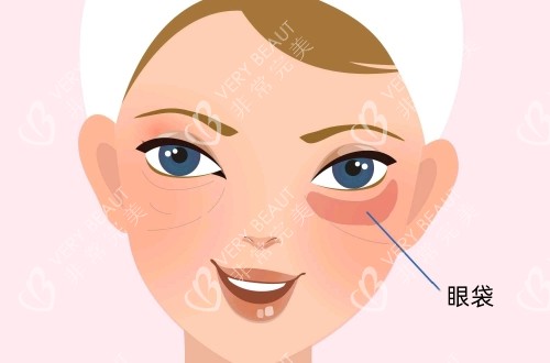 眼袋在眼睛下方的具体位置卡通示意图