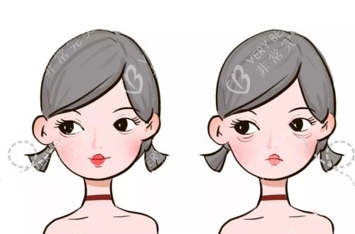 卧蚕和眼袋对人的影响对比示意图
