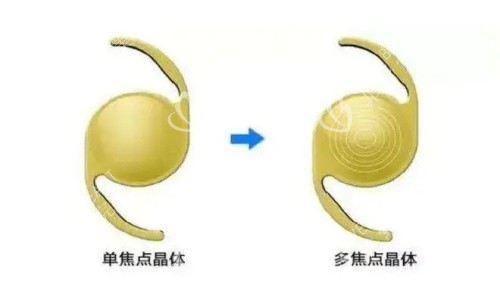 單焦點(diǎn)晶體和雙焦點(diǎn)晶體