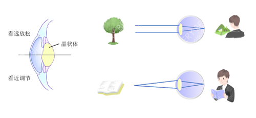 单焦晶体和多焦晶体成像示意图