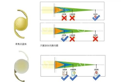 单焦晶体和多焦晶体不同示意图