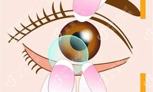 戴隱形眼鏡卡通圖