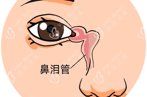 鼻泪管的位置卡通示意图