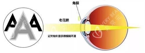 老花眼示意图