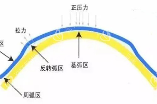 角膜塑形镜对角膜施力示意图