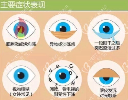 干眼症治疗示意图