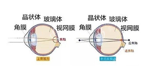 正常视力和老花视力对比