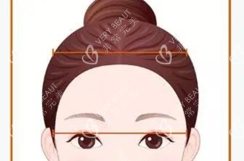 高颅顶的卡通示意图