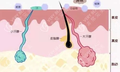 腋臭皮下组织示意图