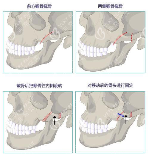 輪廓示意圖