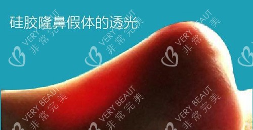 我的鼻子透光