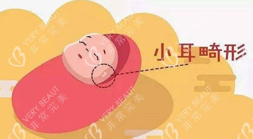 小耳畸形改善展示图