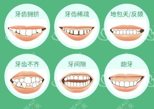 齙牙地包天等示意圖