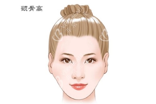 顴骨高卡通圖