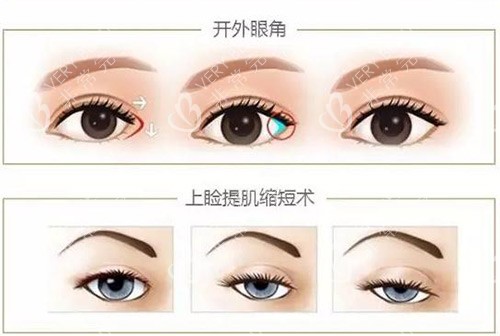 眼綜合示意圖