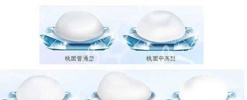 曼陀假體示意圖