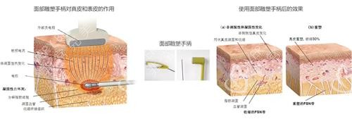 黃金微雕示意圖