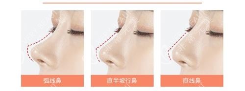 韓國褔萊澤pleasure整形外科隆鼻