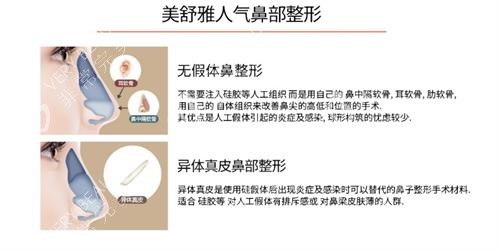 韓國褔萊澤pleasure整形外科人氣鼻整形