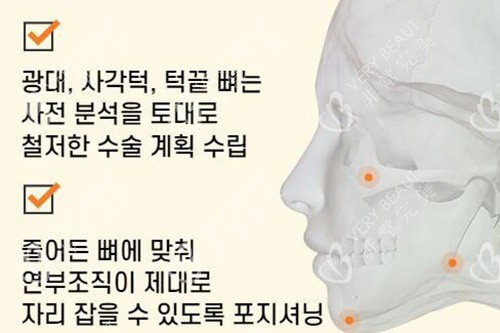 韓國必嫵整形輪廓優(yōu)勢特色