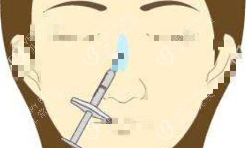 鼻梁填充卡通图