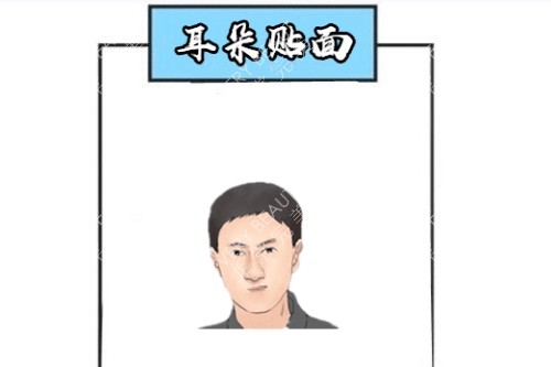 贴面耳卡通图