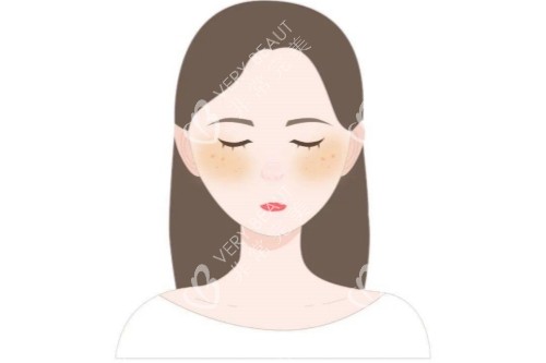 皮膚暗沉卡通圖