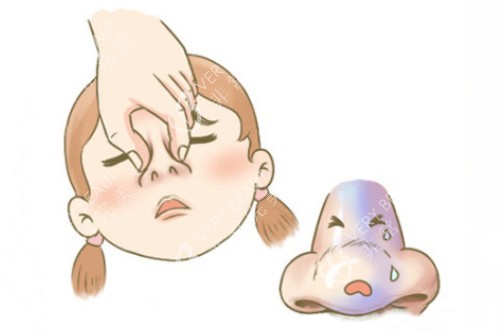 鼻翼肥大