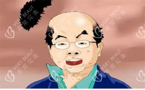 秃头卡通图