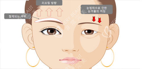 提眉前提眉后动漫对比图