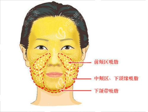 面部脂肪分布图