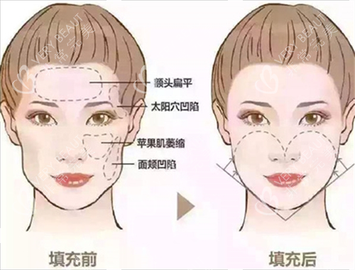 面部填充素材