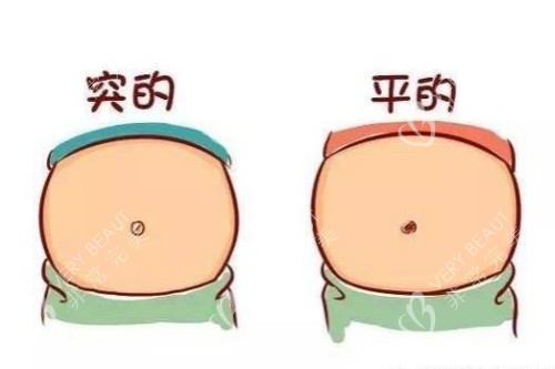 突肚脐和平肚脐卡通图