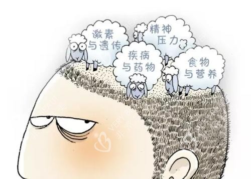 脱发原因