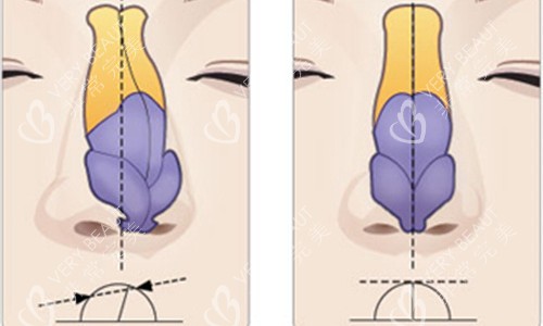 鼻部骨头展示图 鼻部骨头展示图