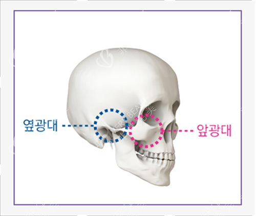 侧颧骨与前脸示意图