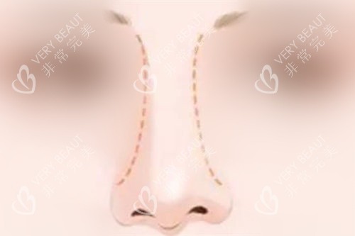 鼻部形态曲线展示图