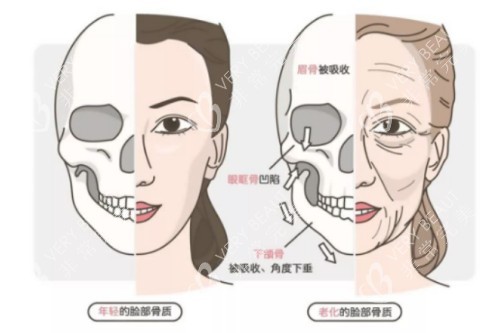 年轻、年老脸部骨骼对比图