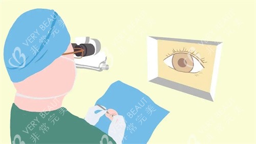 眼部治疗卡通图