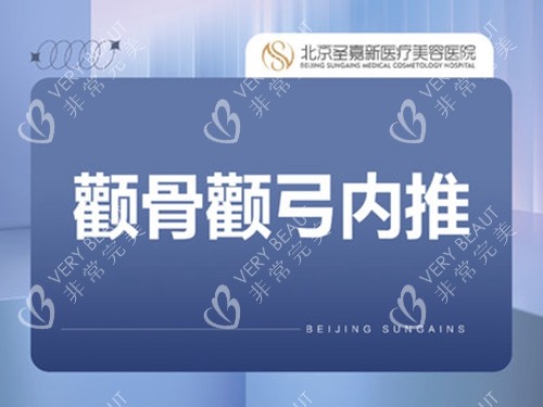 北京圣嘉新医疗美容医院颧弓颧骨整形