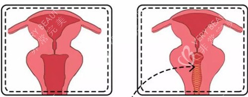 私密手术示意图