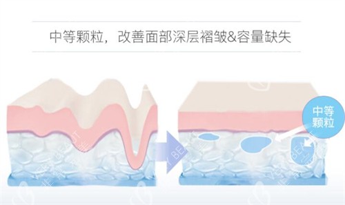 润致3号中等颗粒材料展示