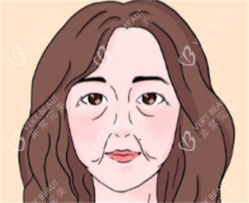 ilift美容仪的适用人群