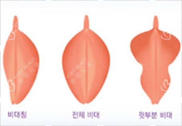 私密部位素材图