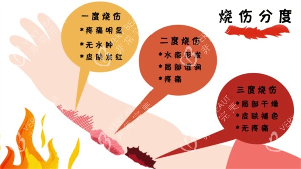 烧伤的分级