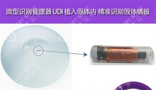 魔滴假体图示
