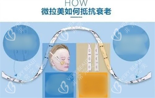 微拉美如何抗衰老