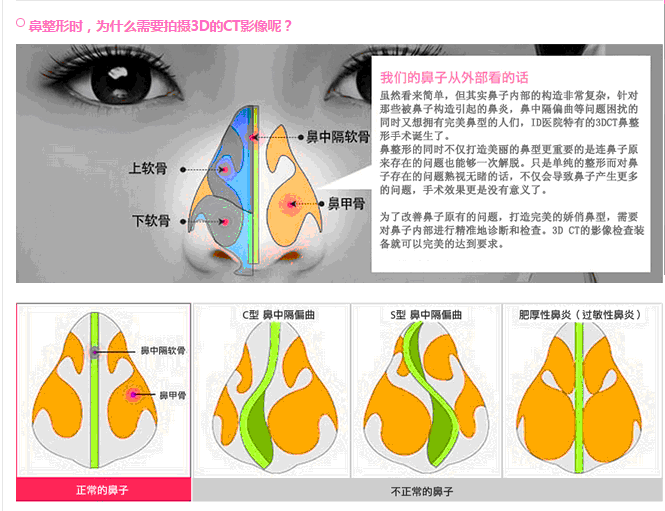 鼻甲3d构造图图片